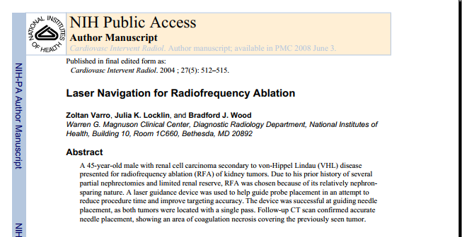 Laser Navigation for Radiofrequency Ablation